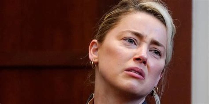 Amber Heard & Johnny Depp: Scary Bruises, Broken Glass & Evidence Of Her Abuse Claims